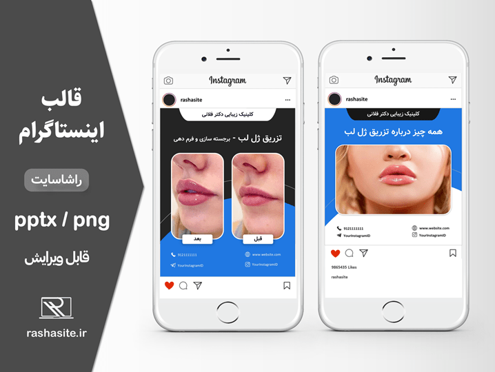 قالب اینستاگرام کلینیک زیبایی